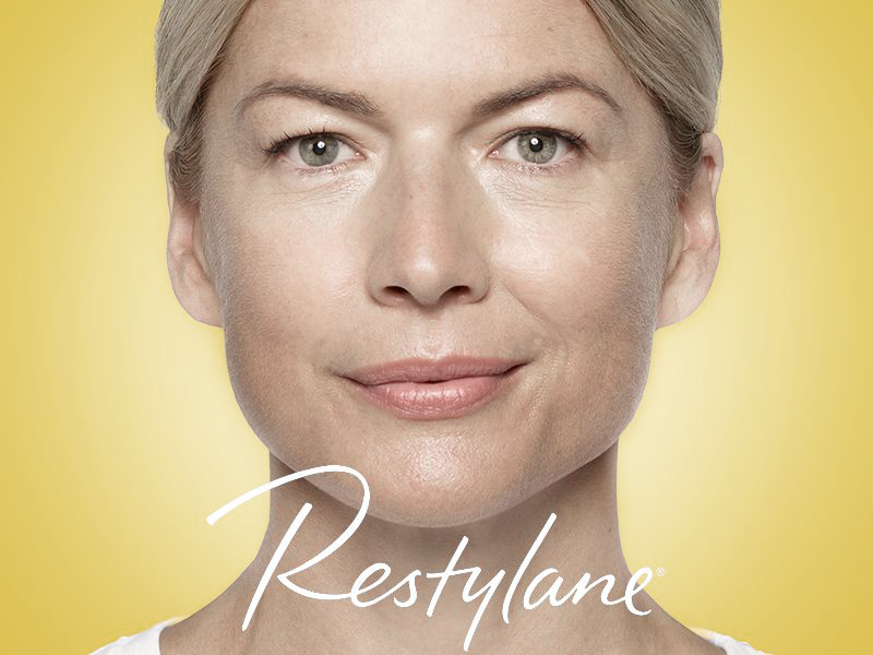 Discounted Restylane treatments in South Miami by Sunset Dermatology.
